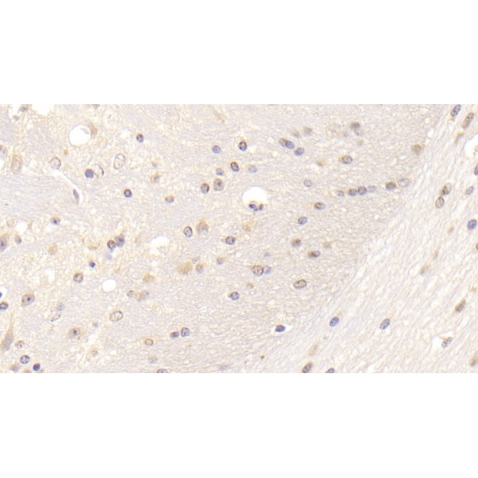 Low Density Lipoprotein Receptor (LDLR) Mouse Polyclonal Antibody