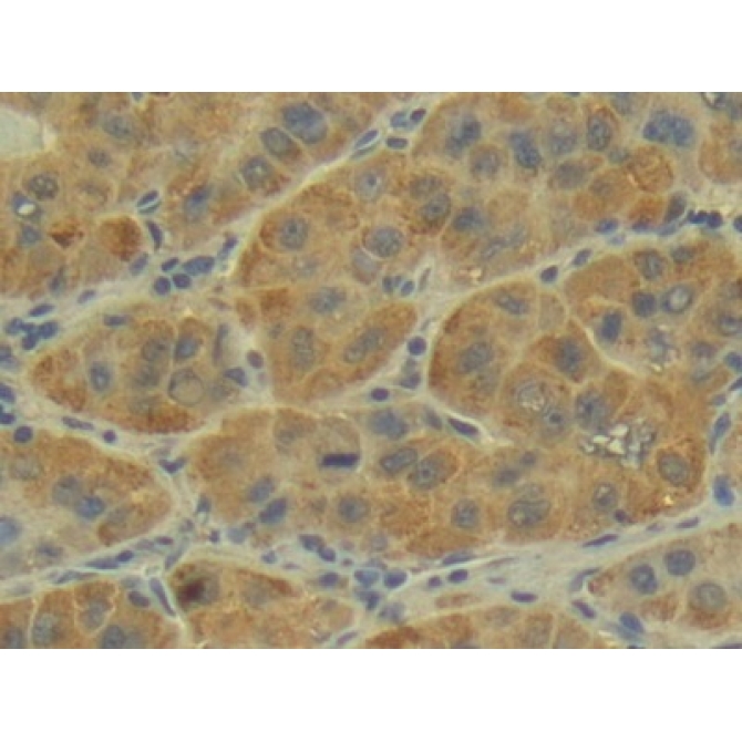 Placental Cadherin (P-cadherin) Human Polyclonal Antibody