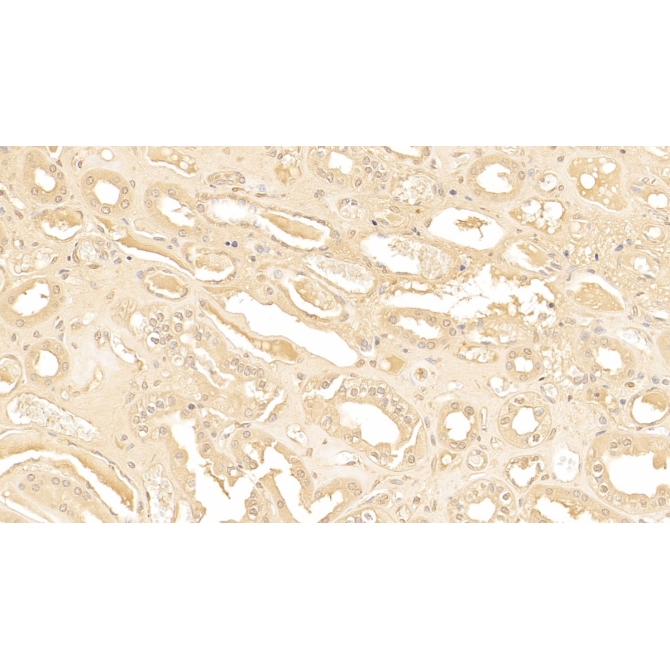Alpha-1-Antichymotrypsin (a1ACT) Human Polyclonal Antibody