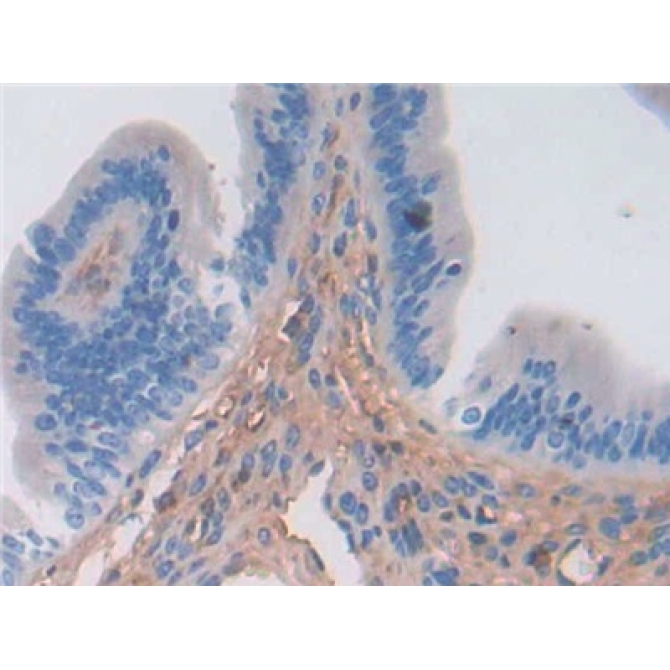 Alpha-1-Antichymotrypsin (a1ACT) Mouse Polyclonal Antibody