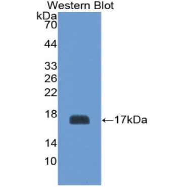 Platelet Glycoprotein Ib Beta Chain (GP1BB) Mouse Polyclonal Antibody