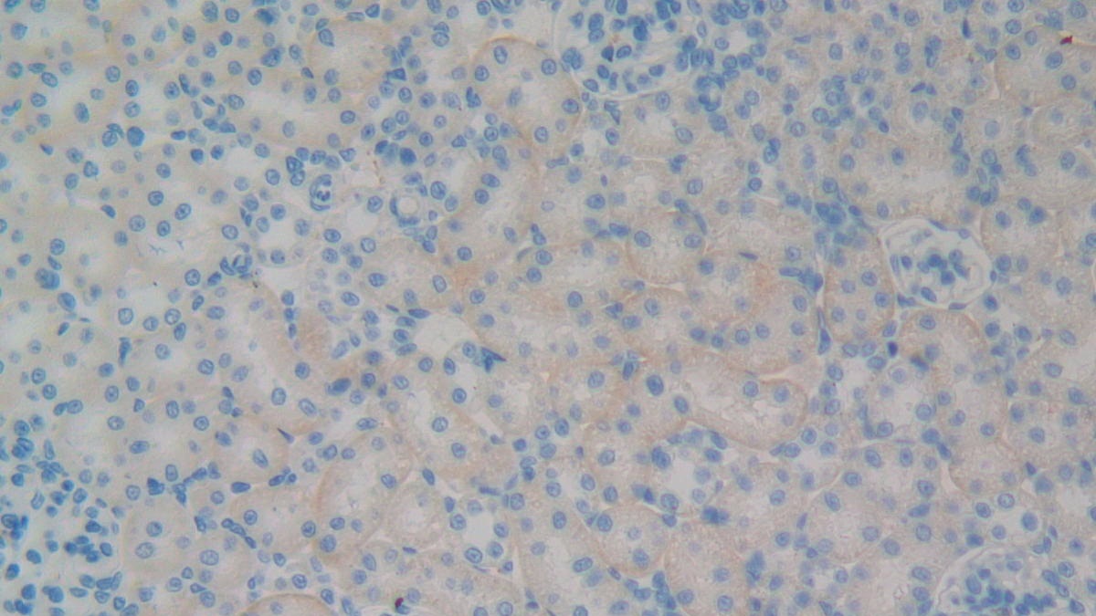Platelet Glycoprotein Ib Beta Chain (GP1BB) Rat Polyclonal Antibody