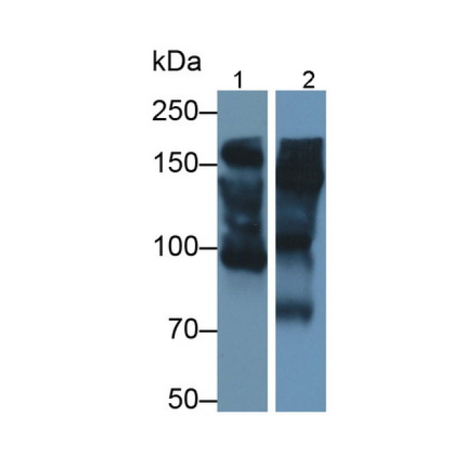 Alpha-2-Macroglobulin (a2M) Mouse Polyclonal Antibody