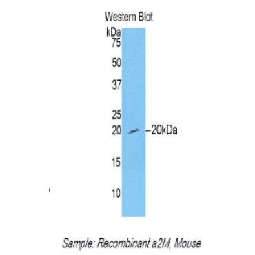 Alpha-2-Macroglobulin (a2M) Mouse Polyclonal Antibody
