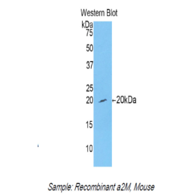Alpha-2-Macroglobulin (a2M) Mouse Polyclonal Antibody
