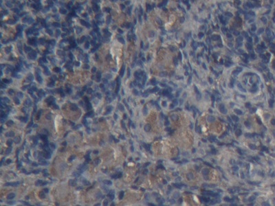Alpha-2-Macroglobulin (a2M) Rabbit Polyclonal Antibody