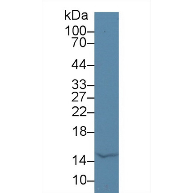 Alpha-Lactalbumin (aLA) Human Polyclonal Antibody