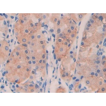 Angiopoietin Like Protein 4 (ANGPTL4) Human Polyclonal Antibody