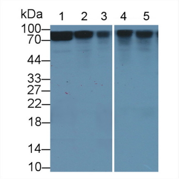 Beta Catenin (Beta-catenin) Human Polyclonal Antibody