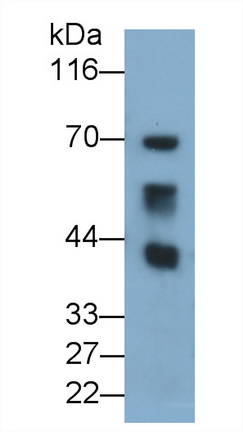 Chemokine C-C-Motif Receptor 10 (CCR10) Rat Polyclonal Antibody