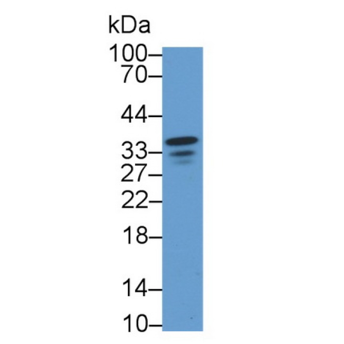 Neuromedin U (NMU) Human Polyclonal Antibody