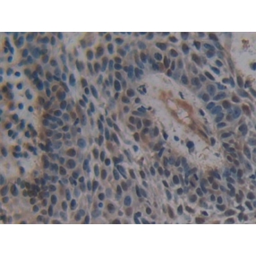 Ubiquitin Activating Enzyme E1 Like Protein (UBE1L) Human Polyclonal Antibody