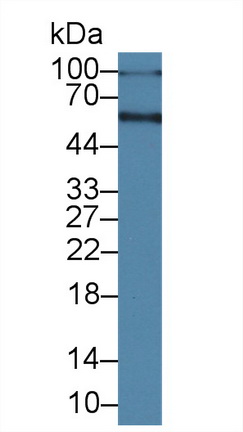 Albumin (ALB) Bovine (Cattle) Polyclonal Antibody