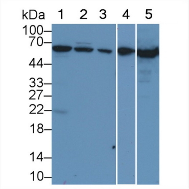 Albumin (ALB) Capra hircus; Caprine (Goat) Polyclonal Antibody