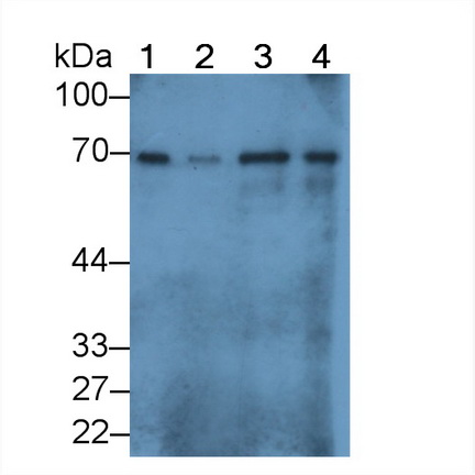 Albumin (ALB) Human Polyclonal Antibody