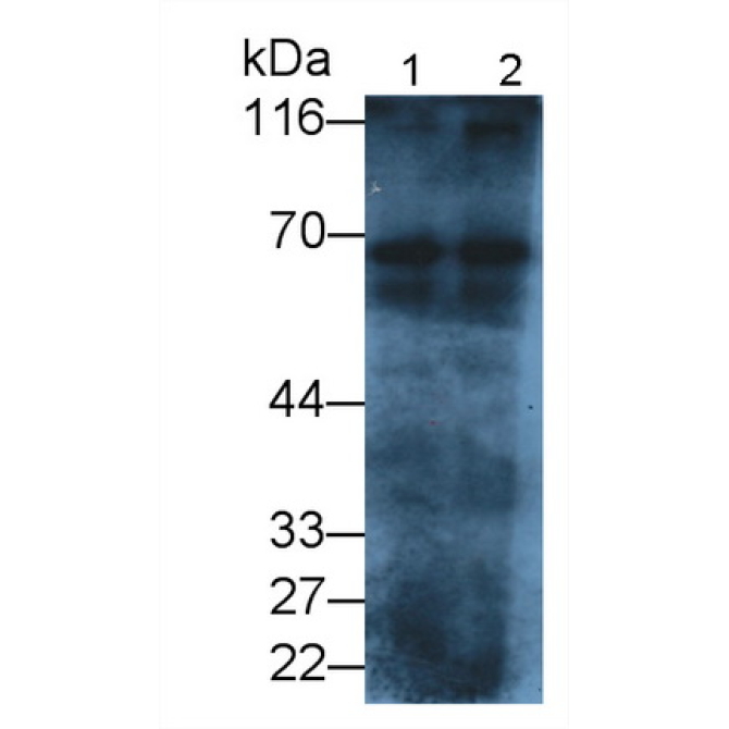 Albumin (ALB) Human Polyclonal Antibody