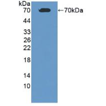 Albumin (ALB) Human Polyclonal Antibody
