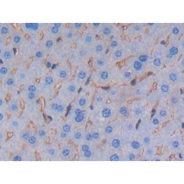 Albumin (ALB) Mouse Polyclonal Antibody