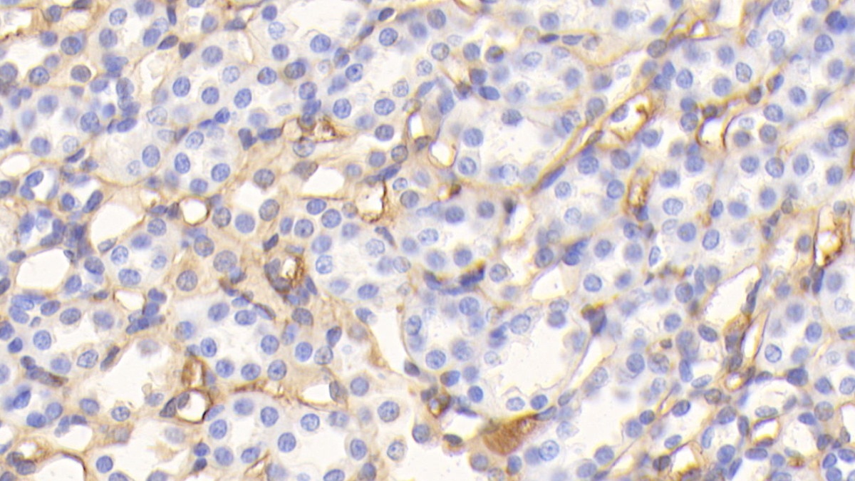 Albumin (ALB) Rat Polyclonal Antibody