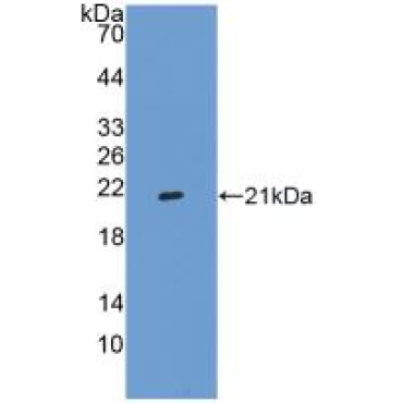 Integrin Alpha 2B (ITGa2B) Human Polyclonal Antibody