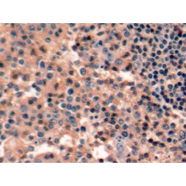 Protein Tyrosine Phosphatase Receptor Type C (CD45) Human Polyclonal Antibody