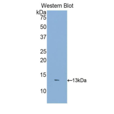 Dickkopf Related Protein 2 (DKK2) Human Polyclonal Antibody