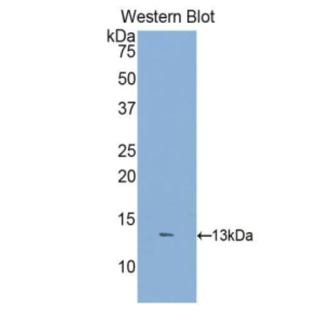 Dickkopf Related Protein 2 (DKK2) Human Polyclonal Antibody