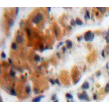 Mucin 4 (MUC4) Human Polyclonal Antibody