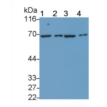 Growth Hormone Receptor (GHR) Human Polyclonal Antibody