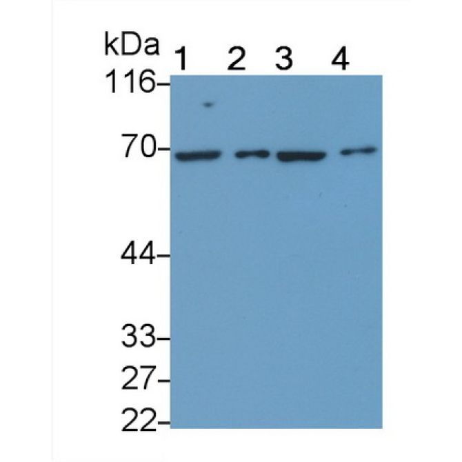 Growth Hormone Receptor (GHR) Human Polyclonal Antibody