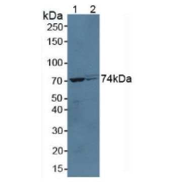 Growth Hormone Receptor (GHR) Mouse Polyclonal Antibody