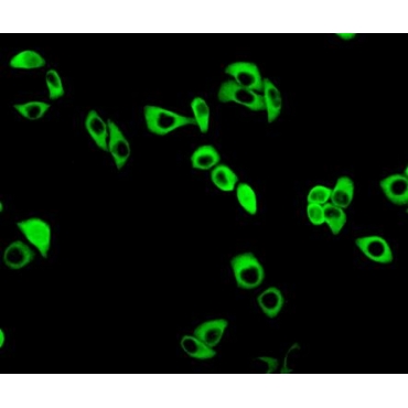 Glutamate Cysteine Ligase, Modifier Subunit (GCLM) Human Polyclonal Antibody