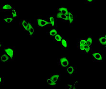Glutamate Cysteine Ligase, Modifier Subunit (GCLM) Human Polyclonal Antibody