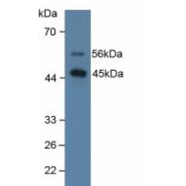 Surfactant Associated Protein D (SPD) Human Polyclonal Antibody