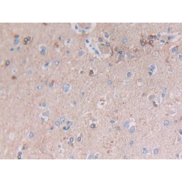 Vimentin (VIM) Human Polyclonal Antibody