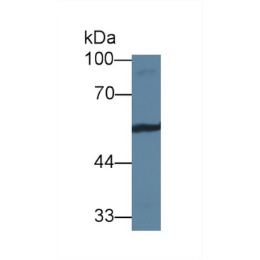 Vitronectin (VTN) Human Polyclonal Antibody