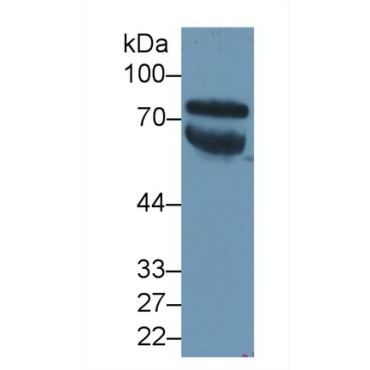 Vitronectin (VTN) Human Polyclonal Antibody