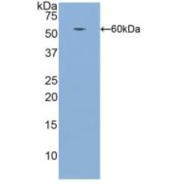 Integrin Beta 1 (ITGb1) Human Polyclonal Antibody