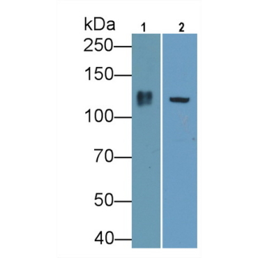 Integrin Beta 1 (ITGb1) Human Polyclonal Antibody
