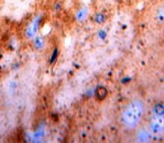 Protein Kinase C Beta 1 (PKCb1) Rat Polyclonal Antibody