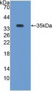 Protein Kinase C Beta 1 (PKCb1) Rabbit Polyclonal Antibody