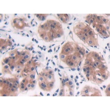Protein Tyrosine Phosphatase Receptor Type B (PTPRB) Human Polyclonal Antibody