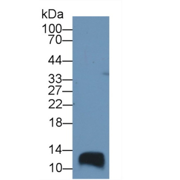 Trefoil Factor 1 (TFF1) Human Polyclonal Antibody