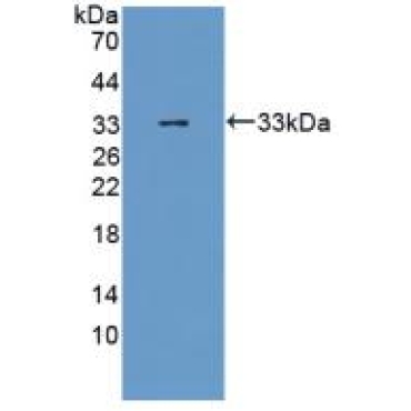 Estrogen Receptor Alpha (ERa) Human Polyclonal Antibody