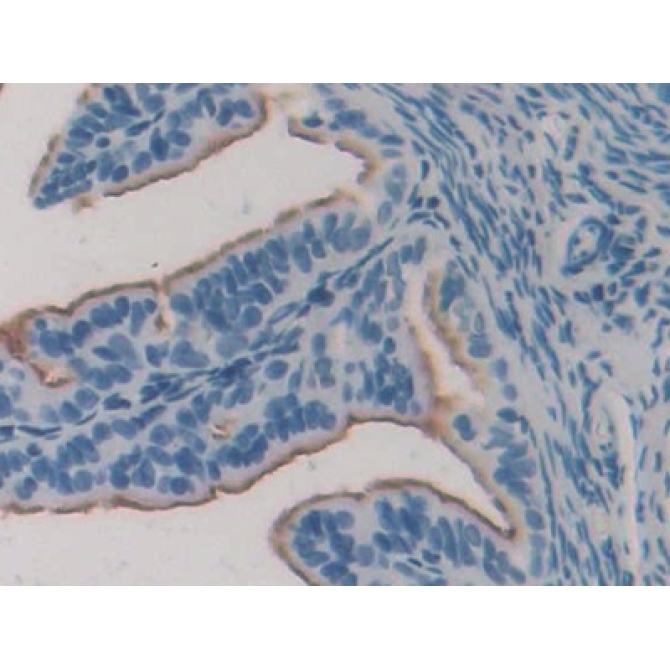 Estrogen Receptor Alpha (ERa) Mouse Polyclonal Antibody