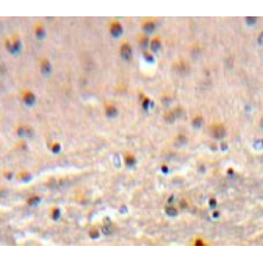Caspase Activated DNase (CAD) Human Polyclonal Antibody