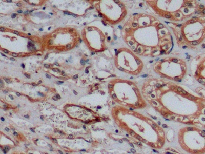 Cluster Of Differentiation 15 (CD15) Human Polyclonal Antibody