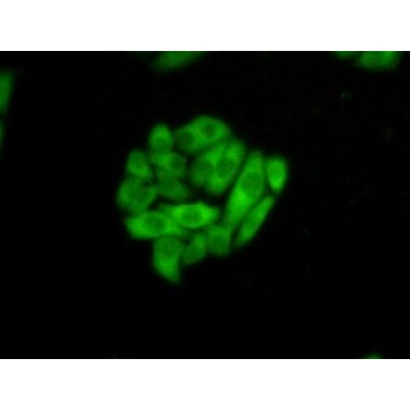 Heat Shock 70kDa Protein 1 Like Protein (HSPA1L) Human Polyclonal Antibody