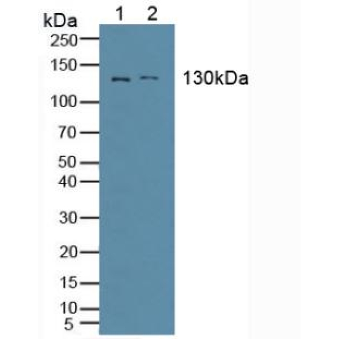 Alanine Aminopeptidase (AAP) Human Polyclonal Antibody