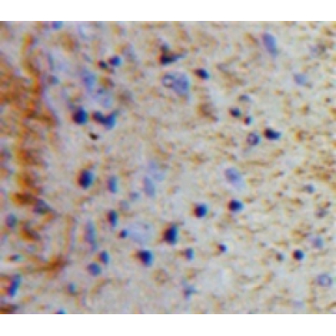Peptide YY (PYY) Human Polyclonal Antibody
